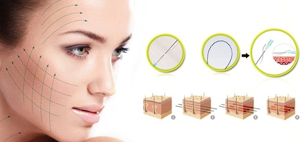Căng da mặt bằng chỉ sinh học