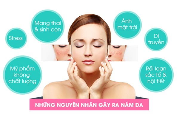 Những nguyên nhân gây nám da