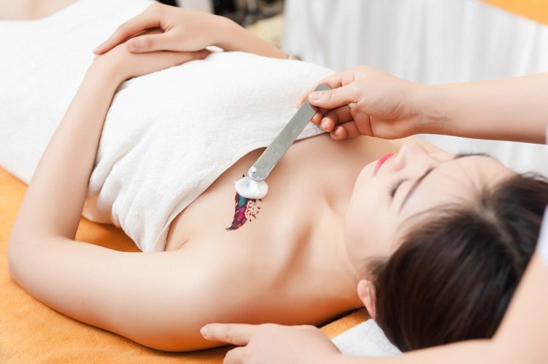 Công nghệ xóa hình xăm tiên tiến, hiện đại
