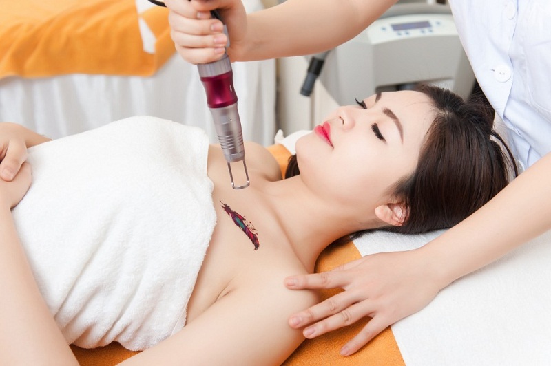 Công nghệ xóa hình xăm