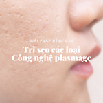 Trị sẹo rỗ triệt để bằng công nghệ Plasma và Eumix 